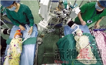  经过5个多小时手术，姐妹俩成功分离。图/记者杨抒怀 