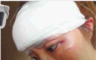 6月20日凌晨，长沙市咸嘉新村嘉和苑的谢女士在小区内遭人抢劫，被缝13针。