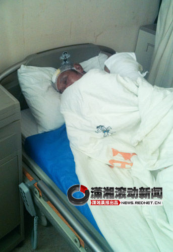 (烧伤男子在湖南旺旺医院接受治疗。 图/潇湘晨报滚动新闻记者 陈斌)